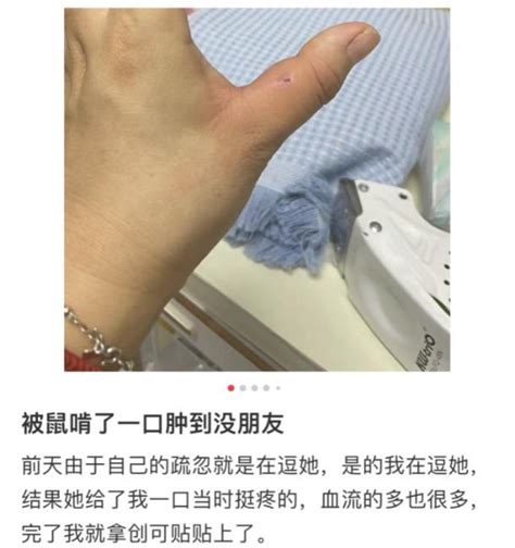 被老鼠咬到|被老鼠咬了有什么症状